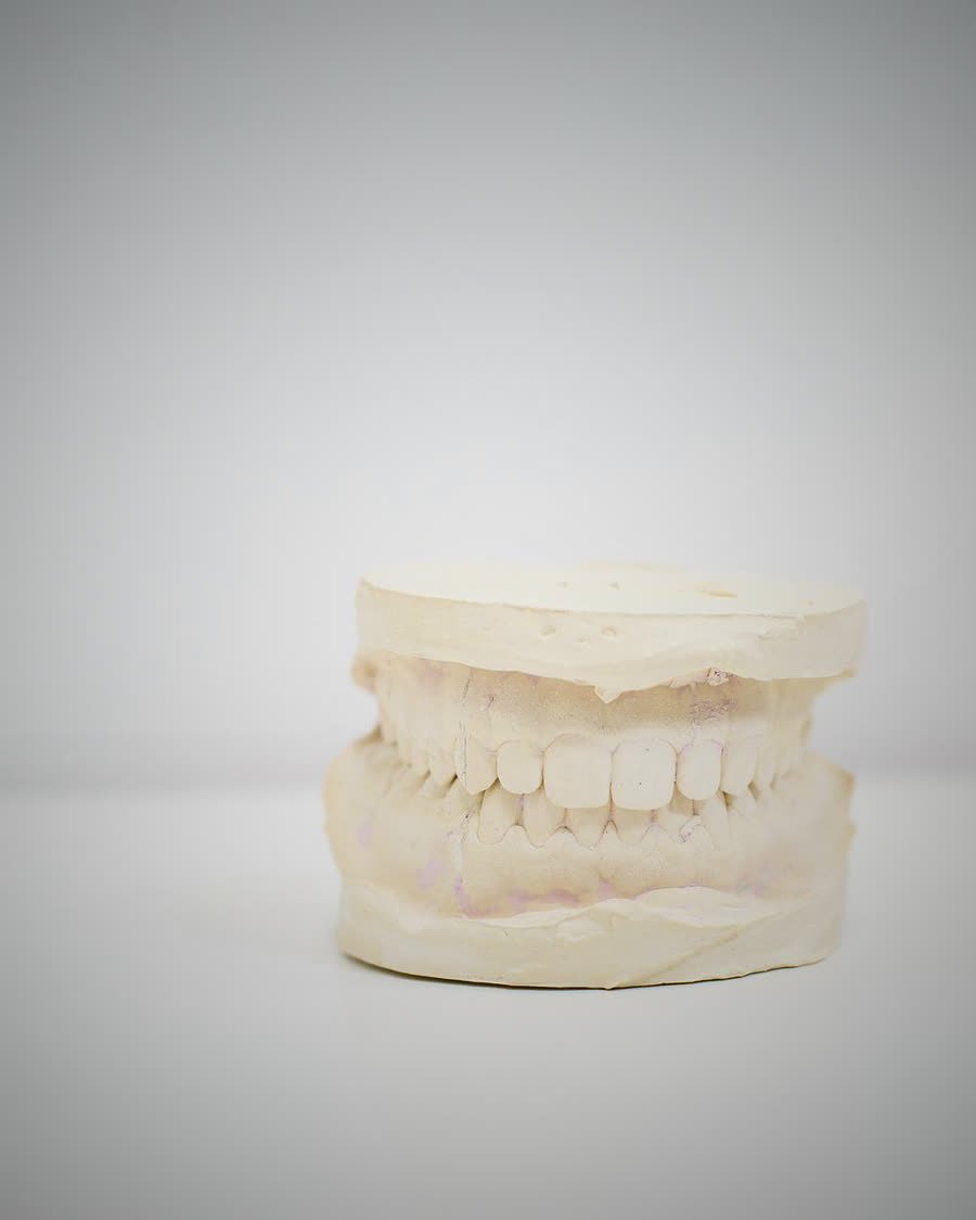 Modelo de arcada dentária — tratamento de canal na Buzzo Odontologia, em Salto SP