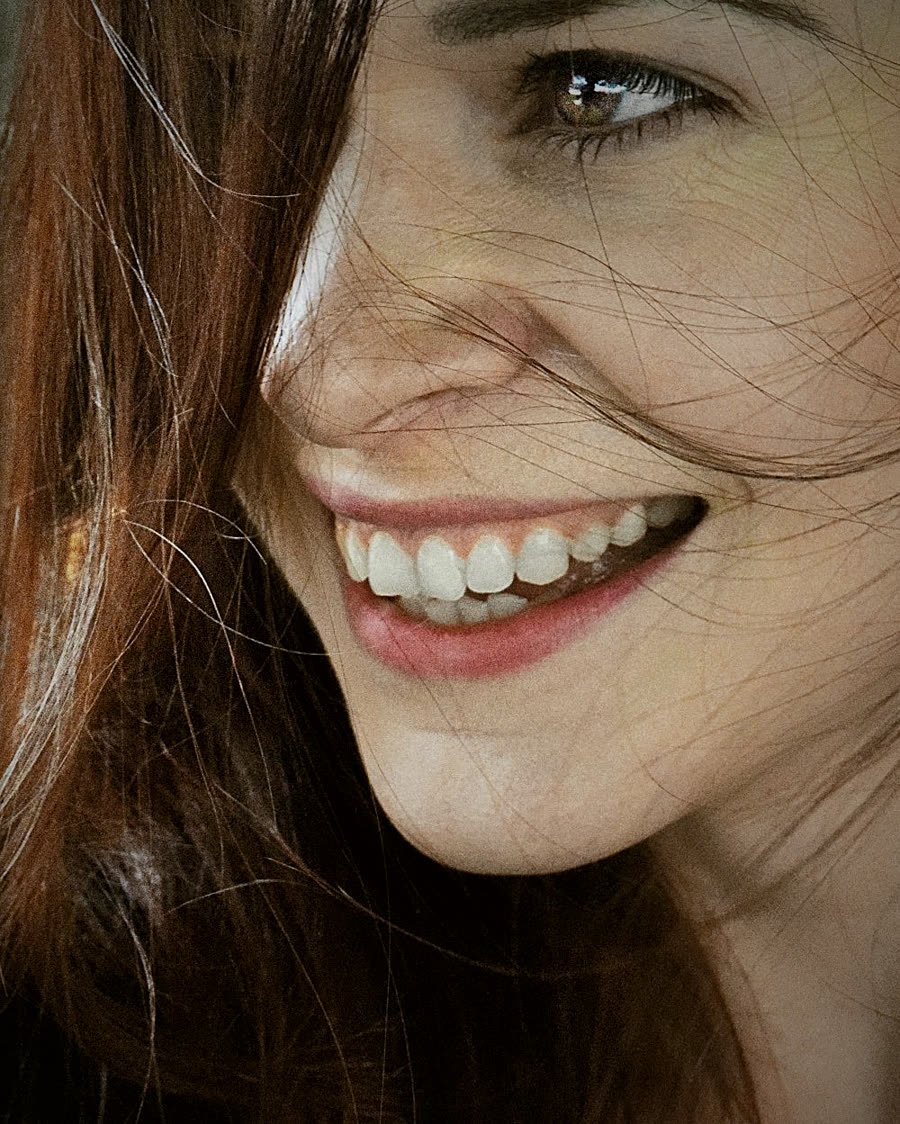 Sorriso natural — facetas e estética do sorriso na Buzzo Odontologia, em Salto SP