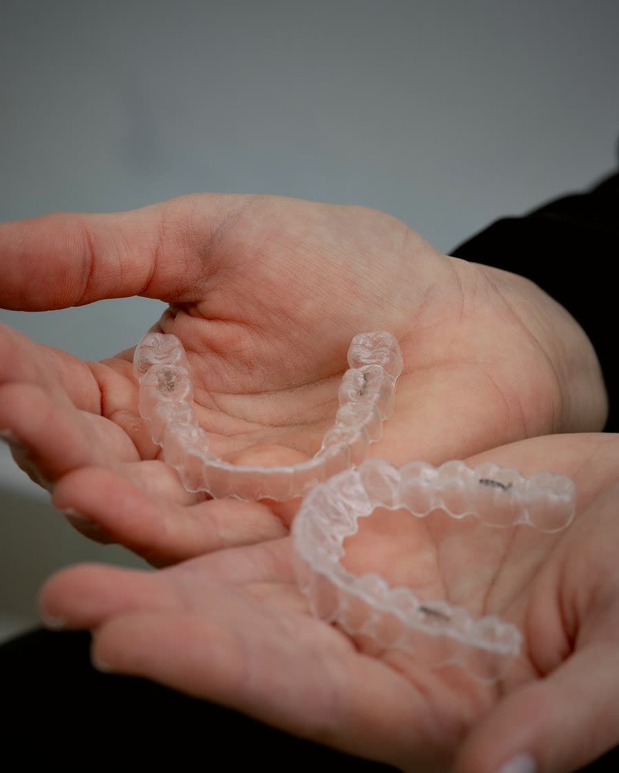 Alinhadores ortodônticos transparentes na Buzzo Odontologia, em Salto SP